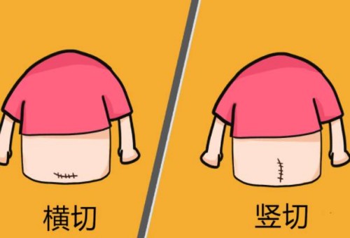 孕中期胎停的原因有哪些，胎停多半和這三點(diǎn)有關(guān)
